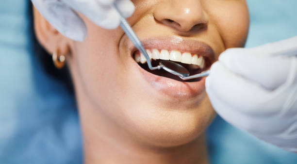 Best Emergency Dentist for Knocked-Out Tooth in Aho Falls, ID