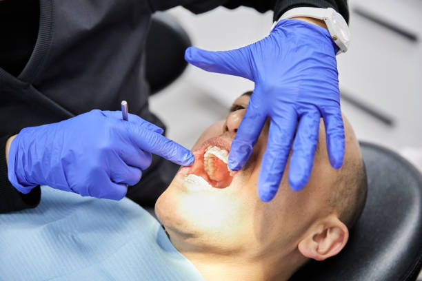 Best Emergency Dental Extractions in Aho Falls, ID